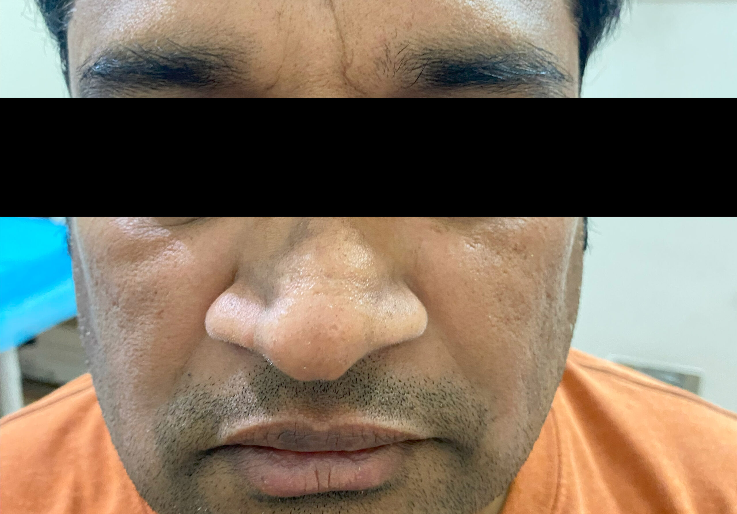 BEFORE ANTI-AGING TREATMENTS. C