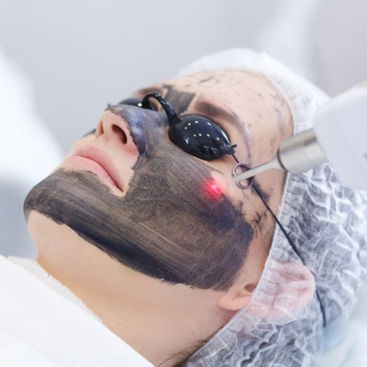 laser treatments